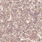 Anti-LC3B MAP1LC3B Rabbit Monoclonal Antibody